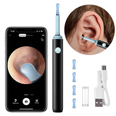 Rechargeable Wireless Ear Camera – Smart Ear Wax Removal Tool