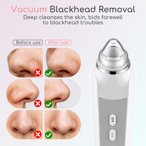 Facial 5 in 1 Blackhead Remover Machine
