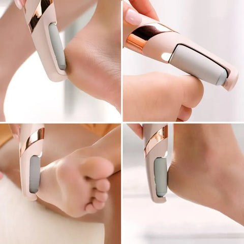 Rechargeable Electric Foot File Callus Remover Pedicure Machine - Electric Pedi Callus Remover