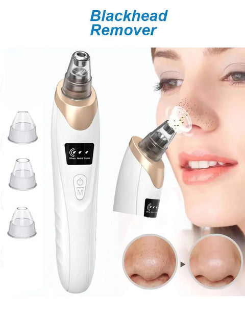 Facial 5 in 1 Blackhead Remover Machine