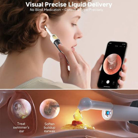 Rechargeable Wireless Ear Camera – Smart Ear Wax Removal Tool